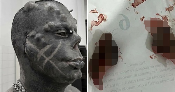 Famous for transforming his body like “Satan”, the man cut off his ears to celebrate his hometown removing the order to wear a mask