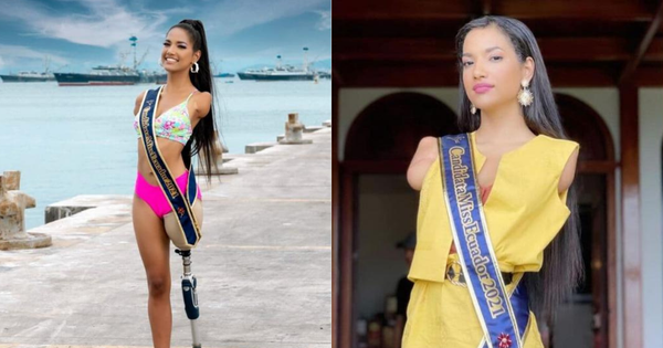 The energetic disabled girl lives 26 years old and the journey to becoming a model