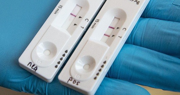 For the first time in more than 5 months, the number of COVID-19 cases is below 500 cases/day