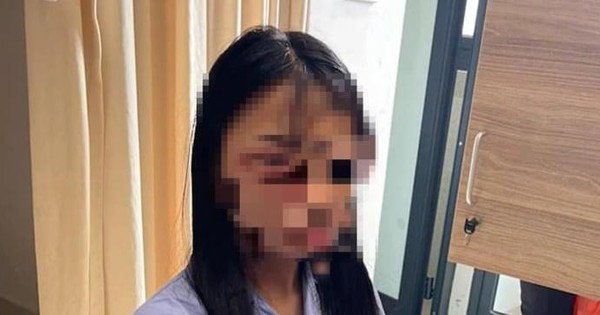 
                                    Công an giám định thương tích nữ sinh lớp 8 ở Hà Nội bị đánh hội đồng