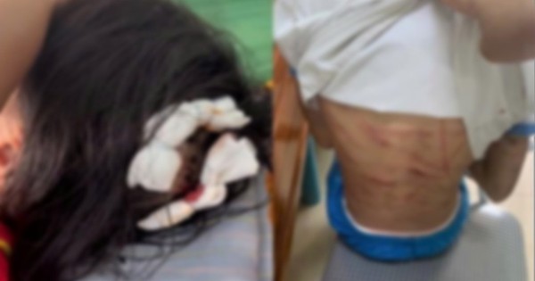 Bé gái lớp 5 nghi bị bố dượng bạo hành đã mở cửa sổ cầu cứu hàng xóm: Thêm loạt chi tiết gây phẫn nộ