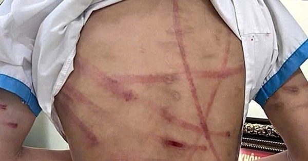 Bắt giữ gã cha dượng bạo hành dã man bé gái lớp 5 ở Hà Tĩnh