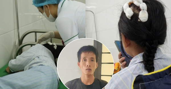 Sức khỏe của bé gái bị cha dượng dùng búa đánh vào đầu hiện ra sao?