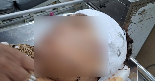 Đồng Tháp: Nữ cán bộ phường khai lý do rạch mặt người phụ nữ nhậu với chồng