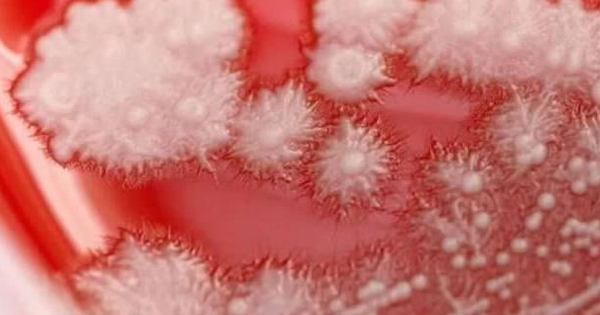 Người đàn ông "họng trắng như tuyết" vì thói quen này của nhiều người