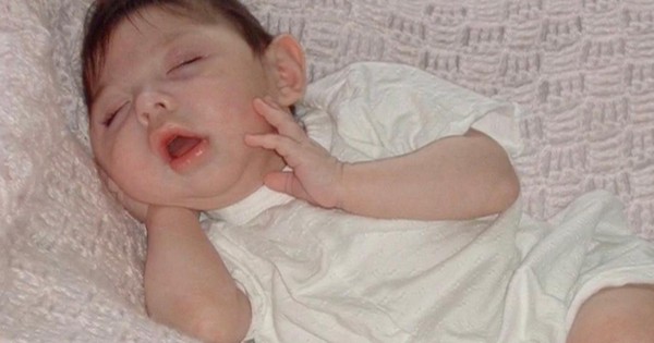 Cô bé sinh ra không có não bây giờ ra sao?