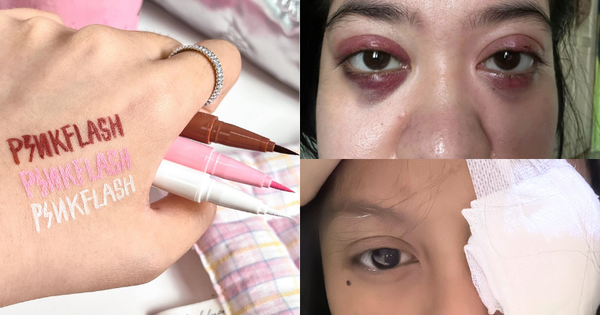 Phấn mắt PINKFLASH dính bê bối lớn: Người dùng bị lẹo mắt hàng loạt, hãng tiêu huỷ, đền tiền gấp đôi
