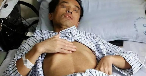 Người đàn ông 53 tuổi mắc ung thư gan, bác sĩ tức giận: Đừng làm việc này quá 3 lần 1 tháng