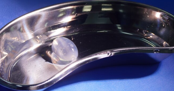 Đặt tinh hoàn nhân tạo cho chàng trai 20 tuổi