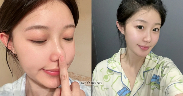 Ở tuổi 27, tôi đã tìm được "chân ái" trị da mụn, lỗ chân lông to