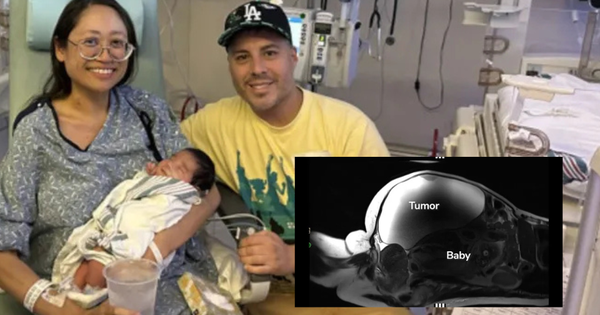 Phép màu y khoa: Em bé chào đời sau 9 tháng phát triển ngoài tử cung, người mẹ không hề biết bản thân mang thai