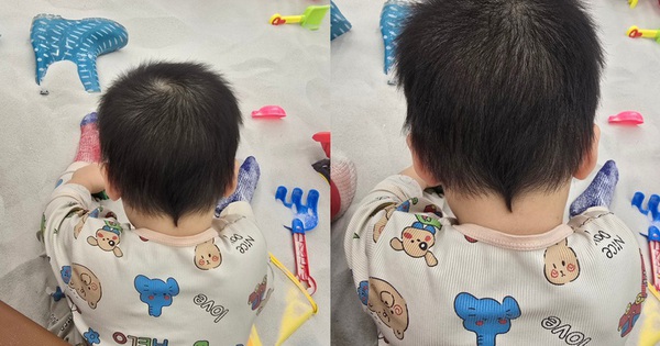 Theo quan niệm dân gian những đứa trẻ có "đuôi dế" thường khó nuôi, nhưng không phải chỉ có như vậy