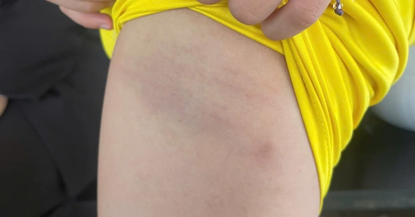 Phạt hành chính, tạm dừng giảng dạy đối với giáo viên dùng dây điện đánh học sinh