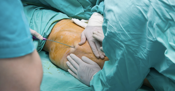 Hút mỡ trái phép, tự quảng cáo là bác sĩ học hàm, học vị “khủng"