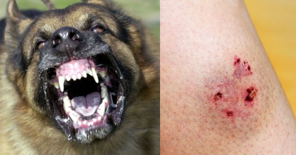 Người đàn ông sinh năm 1968 ở Bình Thuận tử vong sau 2 tháng bị chó cắn vào chân mà chỉ rửa vết thương bằng nước lạnh