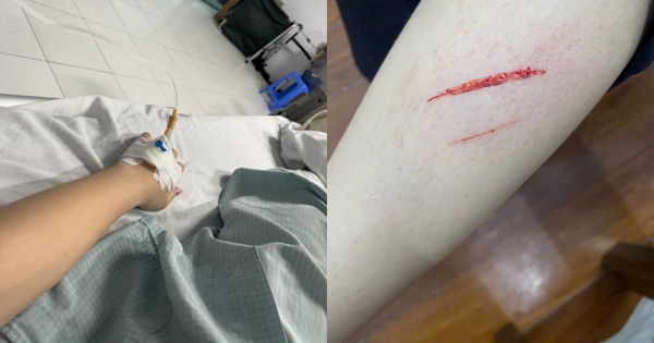 Công an xác minh vụ nữ sinh đi làm thêm bị đồng nghiệp hành hung nhập viện vì tranh cãi "tiền bo" ở Hà Nội