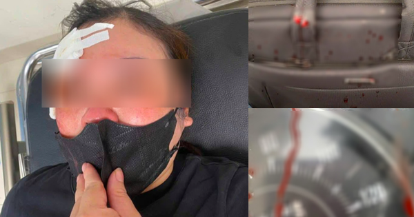 Dừng xe nghe điện thoại, người phụ nữ bị đánh giữa phố Hà Nội bằng gậy sắt: Nguyên nhân được tiết lộ