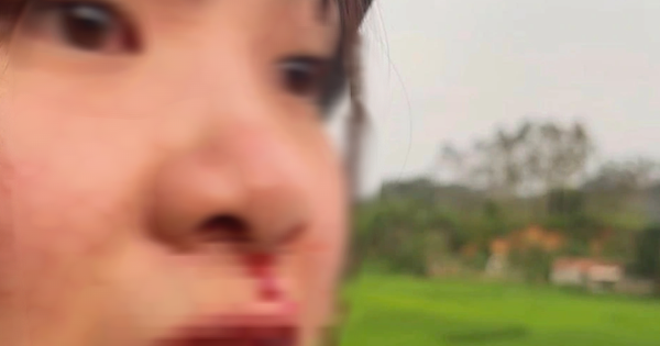 Cô gái 23 tuổi tố vô cớ bị tài xế xe 4 chỗ chặn đầu xe máy, hành hung