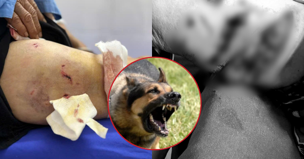 Kinh hoàng cụ bà 77 tuổi ở Yên Bái bị đàn chó lao vào tấn công, chi chít vết thương trên cơ thể