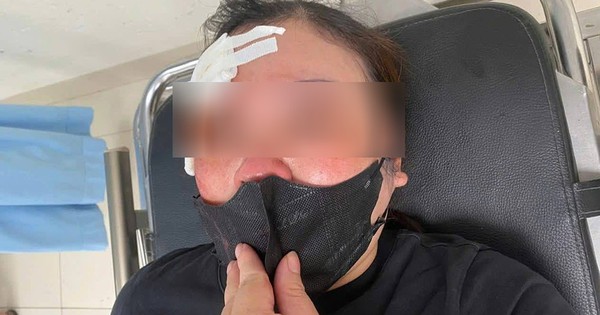 Hà Nội: Người phụ nữ tố bị tài xế ô tô dùng dùi cui đập chảy máu đầu khi đang nghe điện thoại, chưa thể tránh đường