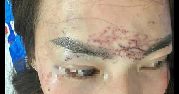 Khởi tố vụ bắt người phụ nữ đem về xăm, cắt tóc và đánh đập gây chấn động dư luận ở Cà Mau