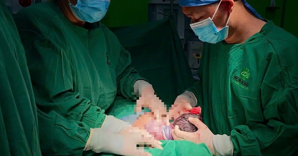 Bé gái ở Quảng Nam chào đời với dây rốn quấn quanh cổ đến 4 vòng