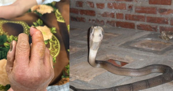 Ra chuồng gà vào buổi tối, người phụ nữ ở Phú Thọ phải đi cấp cứu với bàn tay sưng húp, đau nhức dữ dội