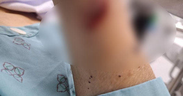 2 phụ nữ chém nhau bị thương nặng vì ghen tuông ở Thái Bình: Hé lộ tình trạng hôn nhân phức tạp