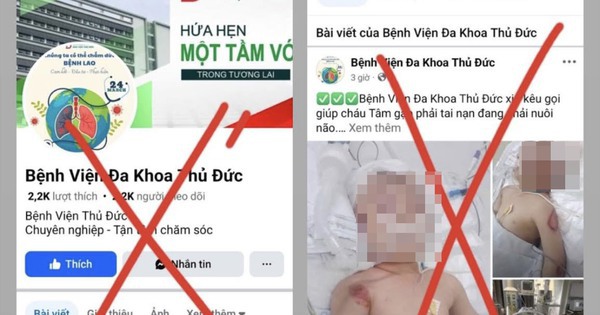 Dựng chuyện cháu bé gặp tai nạn thương tâm để kêu gọi từ thiện