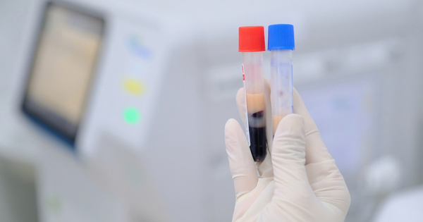 29 tuổi, mỡ máu cao vút dù ăn uống khoa học, cân nặng bình thường: Không ngờ lý do là điều này avatar1755830797291 1755830797587253738592 0 0 811 1298 crop 1755830810436986043077