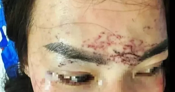 Diễn biến vụ 2 phụ nữ đánh ghen, đổ axit, xăm mặt người khác ở Cà Mau