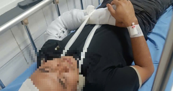 Nghi án tranh giành địa bàn cứu hộ, một tài xế bị đánh gãy tay