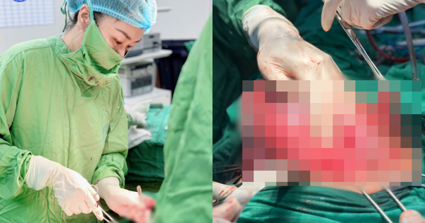 Mổ cấp cứu cho sản phụ mang thai 34 tuần có ruột thừa vỡ mủn nát: Ca mổ liên viện cứu sống cả hai mẹ con trong gang tấc