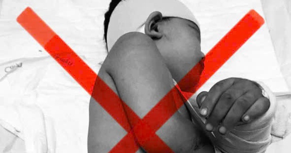 Cảnh báo việc kêu gọi "giúp đỡ bé Đỗ Minh Khoa ở Tây Ninh"