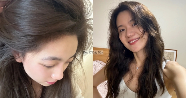 Gallery - Muốn tóc mọc nhanh, khỏe và dày hơn thì nhất định phải sử dụng 5 sản phẩm này