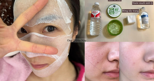 Không dùng mỹ phẩm đắt tiền, tuổi 25 tôi thu nhỏ lỗ chân lông của mình nhờ 4 bước này!