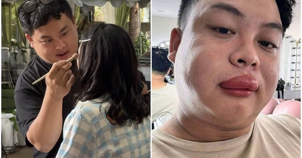 Cô dâu bị ong đốt, thợ make up đến “cứu” cũng bị đốt sưng môi: Người trong cuộc kể chuyện hy hữu