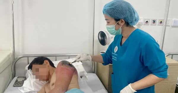 Đừng để "mẹo dân gian" biến chấn thương nhẹ thành nhiễm trùng nặng