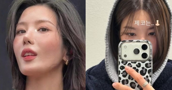 Kwon Eunbi che mũi trong ảnh mới, dấy lên nghi vấn phẫu thuật thẩm mỹ