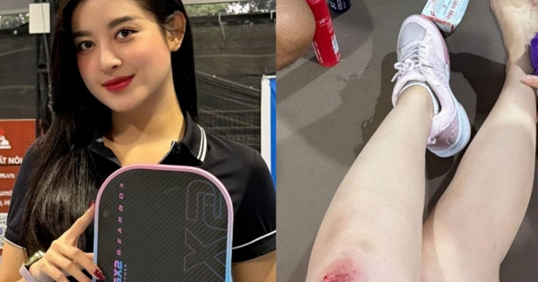 Á hậu Huyền My gặp tai nạn khi chơi pickleball