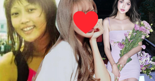 Cô gái cao 1m80 bị ép dao kéo từ năm 14 tuổi, hơn 300 lần phẫu thuật: Gương mặt hiện tại thế nào?