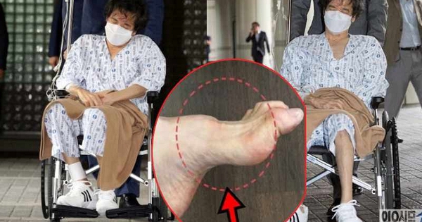 Gia tộc Samsung và căn bệnh di truyền đáng sợ mang tên teo cơ MÁC: Có tất cả nhưng cũng không thể chữa khỏi