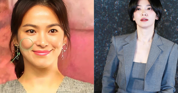 Tránh sai lầm khi chống lão hóa vùng “má hồng“: Đừng vội tiêm chất làm đầy, hãy làm việc này trước để trẻ lại