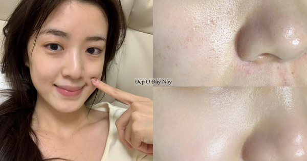 5 serum ngừa lão hóa 