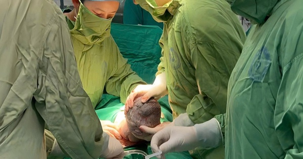 Em bé sinh ra với "đôi cánh nhỏ" trên lưng: Mẹ ơi! Con đến với mẹ rồi đây!