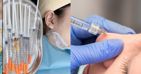 Cô gái ở TP.HCM gặp biến chứng sau mũi tiêm 27 triệu tại nhà, người thực hiện 