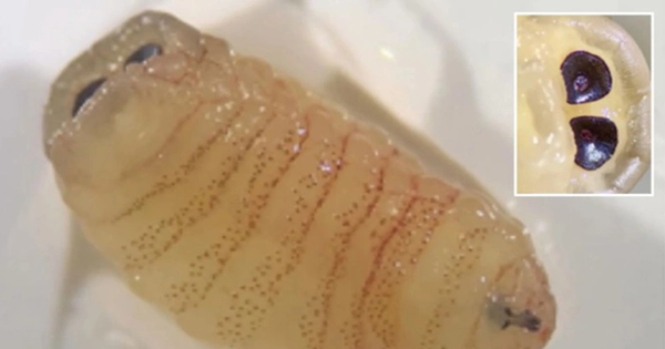 Người phụ nữ 58 tuổi “sốc nặng” khi hắt hơi ra hàng loạt con giòi sống từ trong mũi