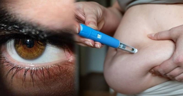 Giảm 10kg sau 4 tháng tiêm “bút giảm cân”, người đàn ông bàng hoàng khi tỉnh dậy bị đột quỵ mắt, một bên không nhìn thấy gì