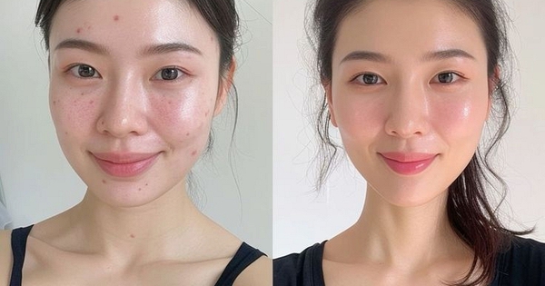 Sáng thức dậy làm 5 việc này, da dẻ đẹp lên từng ngày, nếp nhăn khó mà xuất hiện