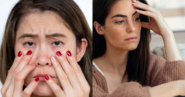 Mới 30+ đã tóc bạc, dễ tăng cân, hay quên: Không phải vì tuổi tác, mà bạn đang lão hoá do stress, có 3 dấu hiệu thì đừng bỏ qua